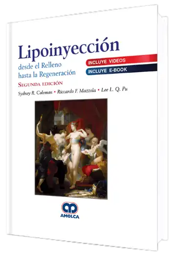 Lipoinyección Desde el Relleno hasta la Regeneración 2 Edición