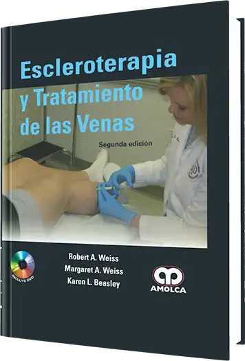 Escleroterapia y Tratamiento de las Venas. 2 Edición