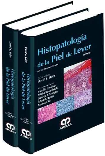 Histopatología de la Piel de Lever. 11 Edición