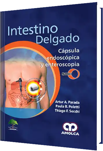 Intestino Delgado. Cápsula Endoscópica y Enteroscopia