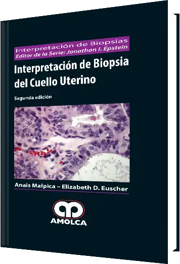 Interpretación de Biopsia del Cuello Uterino 2 Edición
