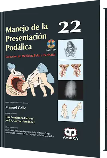 Manejo de la Presentación Podálica. Volumen 22