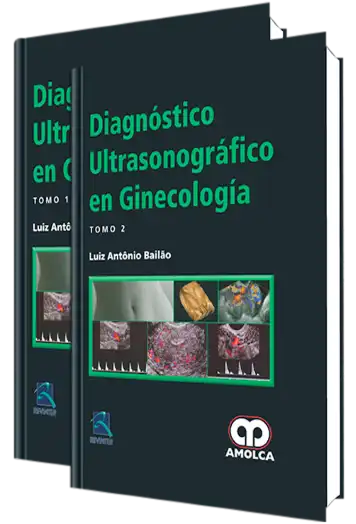 Diagnóstico Ultrasonográfico en Ginecología