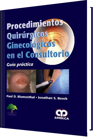 Procedimientos Quirúrgicos Ginecológicos en el Consultorio