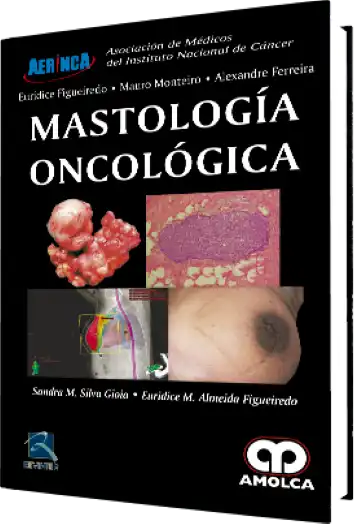 Mastología Oncológica