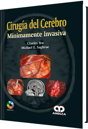 Cirugía del Cerebro Mínimamente Invasiva