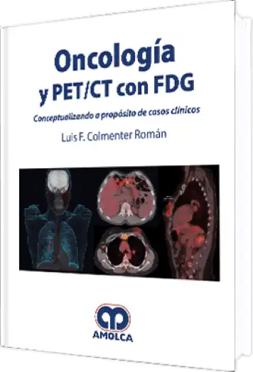 Oncología y PET / CT con FDG