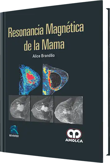 Resonancia Magnética de la Mama