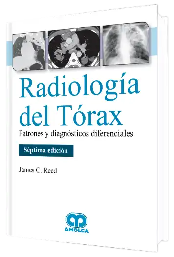 Radiología del Tórax. Patrones y Diagnósticos Diferenciales. 7 Edición