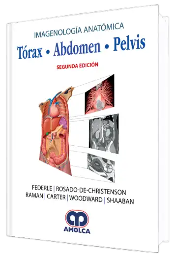 Imagenología Anatómica. Tórax, Abdomen, Pelvis. 2 Edición