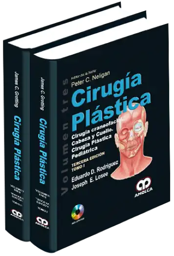 Cirugía Plástica - Cirugía Craneofacial, Cabeza y Cuello. Cirugía Plástica Pediátrica 3 Edición, Volumen 3