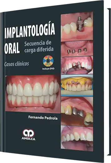 Implantología Oral