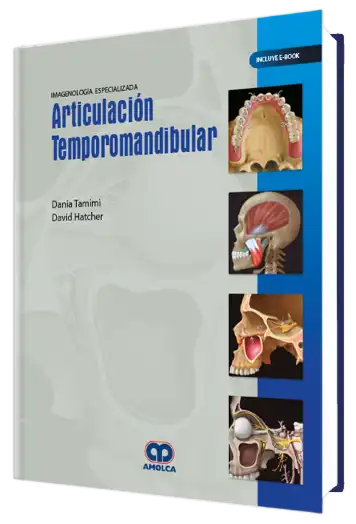 Imagenología Especializada. Articulación Temporomandibular