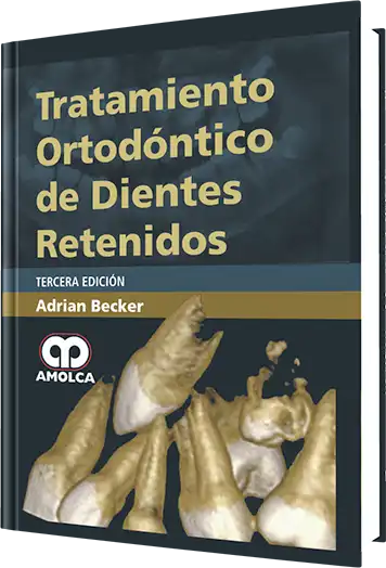 Tratamiento Ortodóntico de los Dientes Retenidos. 3  Edición