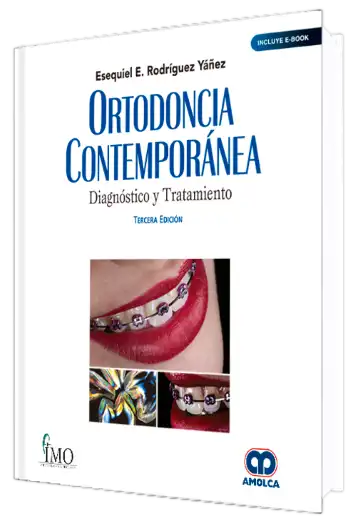 Ortodoncia Contemporánea. Diagnóstico y Tratamiento. 3 Edición
