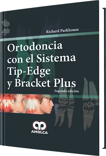 Ortodoncia con el Sistema Tip-Edge y Bracket Plus. 2 Edición