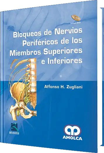 Bloqueos de Nervios Periféricos de los Miembros Superiores e Inferiores