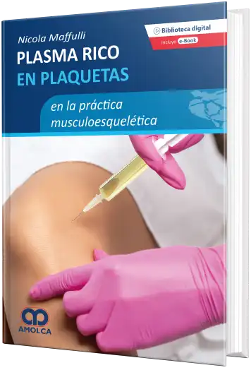 Plasma Rico en Plaquetas en la Práctica musculoesquelética