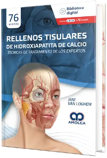 Rellenos Tisulares de Hidroxiapatita de Calcio. Técnicas de tratamiento de los expertos