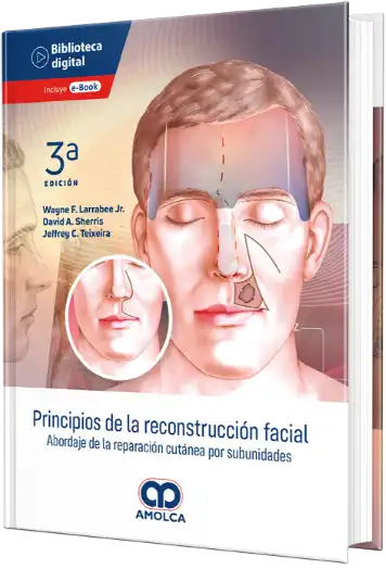 Principios de la reconstrucción facial. Abordaje de la reparación cutánea por subunidades. 3a Edición